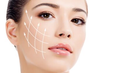 Hilos tensores Silhouette Soft: La solución noquirúrgica para rejuvenecer el rostro