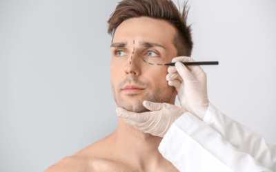 Deshazte de las ojeras: Guía completa de tipos, prevención y tratamientos efectivos