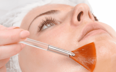 El poder del peeling y la limpieza facial en la medicina estética